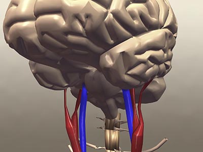 stroke mortality s