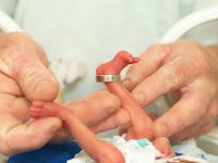 Prematurity, low birth weight significantly impact mortality rates