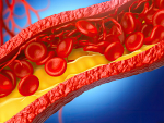 3D in vitro human atherosclerosis model for high-throughput drug screening