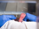 Nano-preterm infants may not benefit from noninvasive versus invasive ventilation at birth