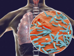 The tuberculosis pathogen releases its toxin by a novel protein transport system