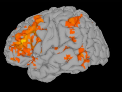 Autistic children improved reading and brain activity after 10-week reading intervention