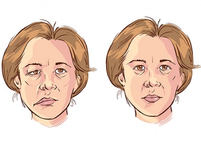 Facial nerve clinic to provide comprehensive personalized care