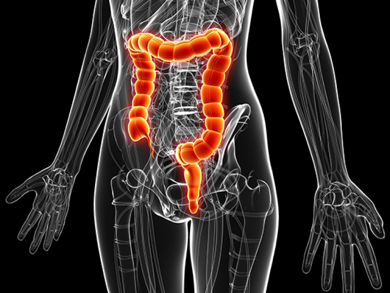 Fecal-dominant donor microbes in the recipient patients after fecal microbe transplantation did not correlate with response to anti-PD-1 therapy.