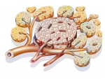 Diabetes: TXNIP involved in increased secretion of glucagon from pancreatic alpha cells