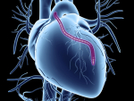 Cardiac bypass surgeries declined in 2020, but outcomes show the procedures were done safely during the COVID-19 pandemic