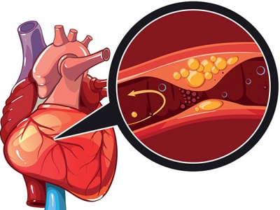 Neonatal pig hearts can heal from heart attack