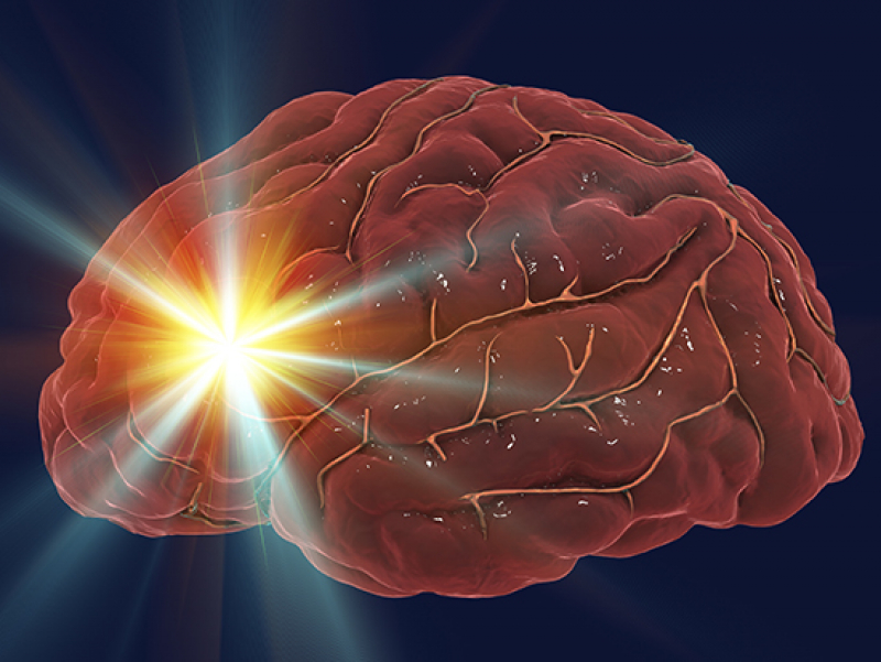 Stroke patients with COVID-19 have increased inflammation, stroke severity and death