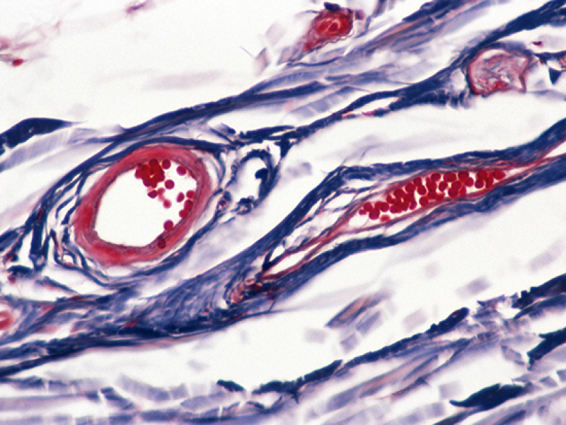 In this arteriolar niche, breast cancer stem cells and arteriolar endothelial cells cross-talk using a well-known signaling pathway. Targeting this pathway may offer therapeutic potential.