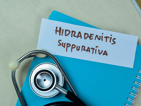 Study reveals the disruption of interaction between proteins CD2:CD58 is a potential new treatment option for people with hidradenitis suppurativa