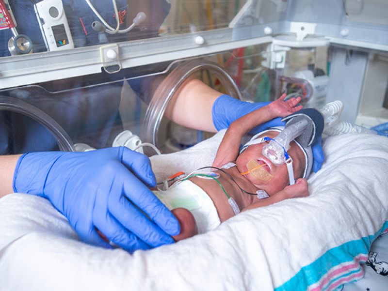 Higher-volume feedings help postnatal growth in preterm infants