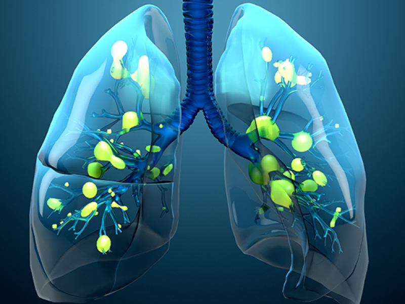 Acute respiratory failure mortality increases in United States and may worsen with COVID-19 pandemic