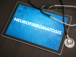 UAB-led Neurofibromatosis Clinical Trials Consortium funded for 10 more years