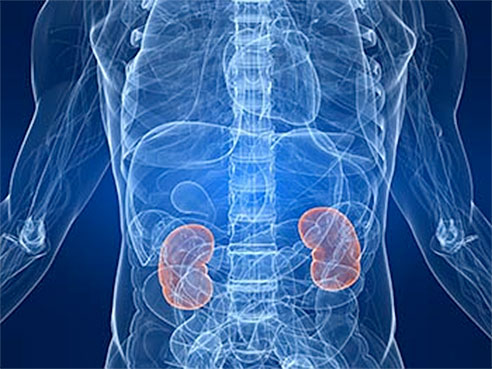 kidney damage f