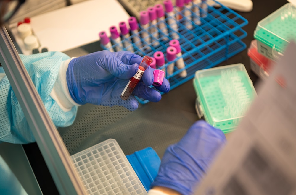 rep molecular labs hands blood samples 1000x660px