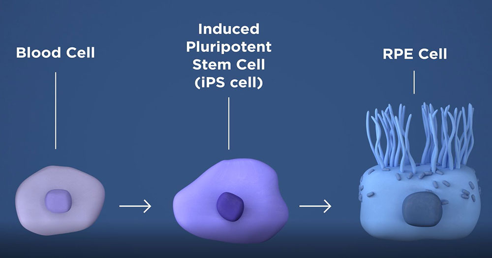 rep nih ips cells 1000px