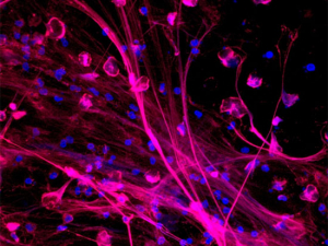 Could NET-wielding neutrophils be driving respiratory distress and death in COVID-19 patients?