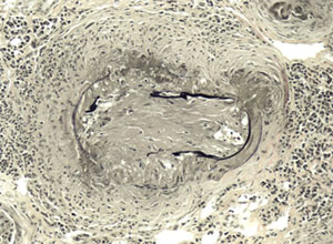 Verhoeff's method for elastin