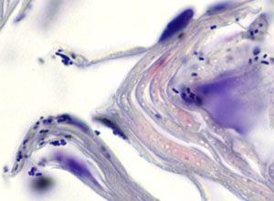 Gram stains (various methods) for bacteria